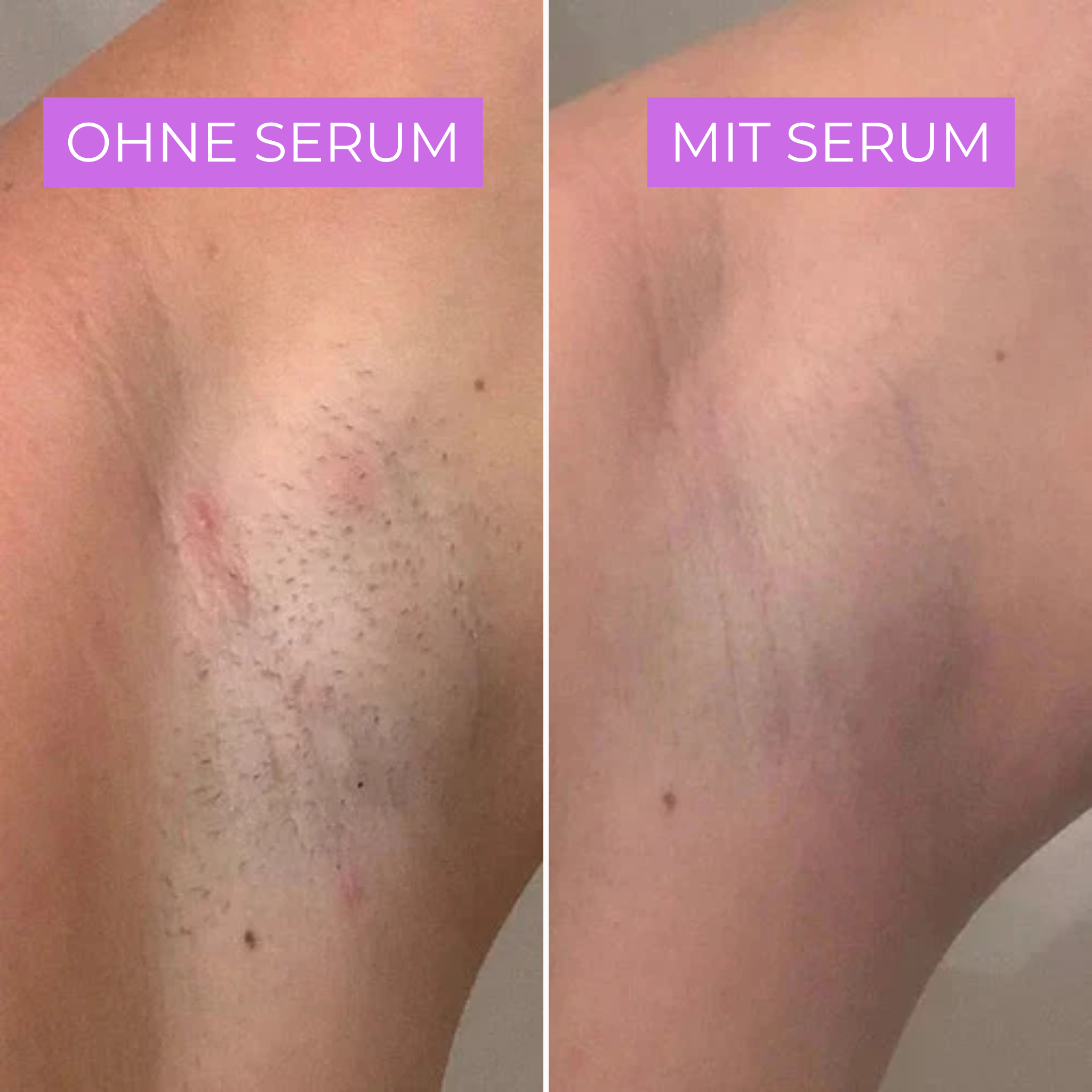 Cyperin Anti-Haar Serum