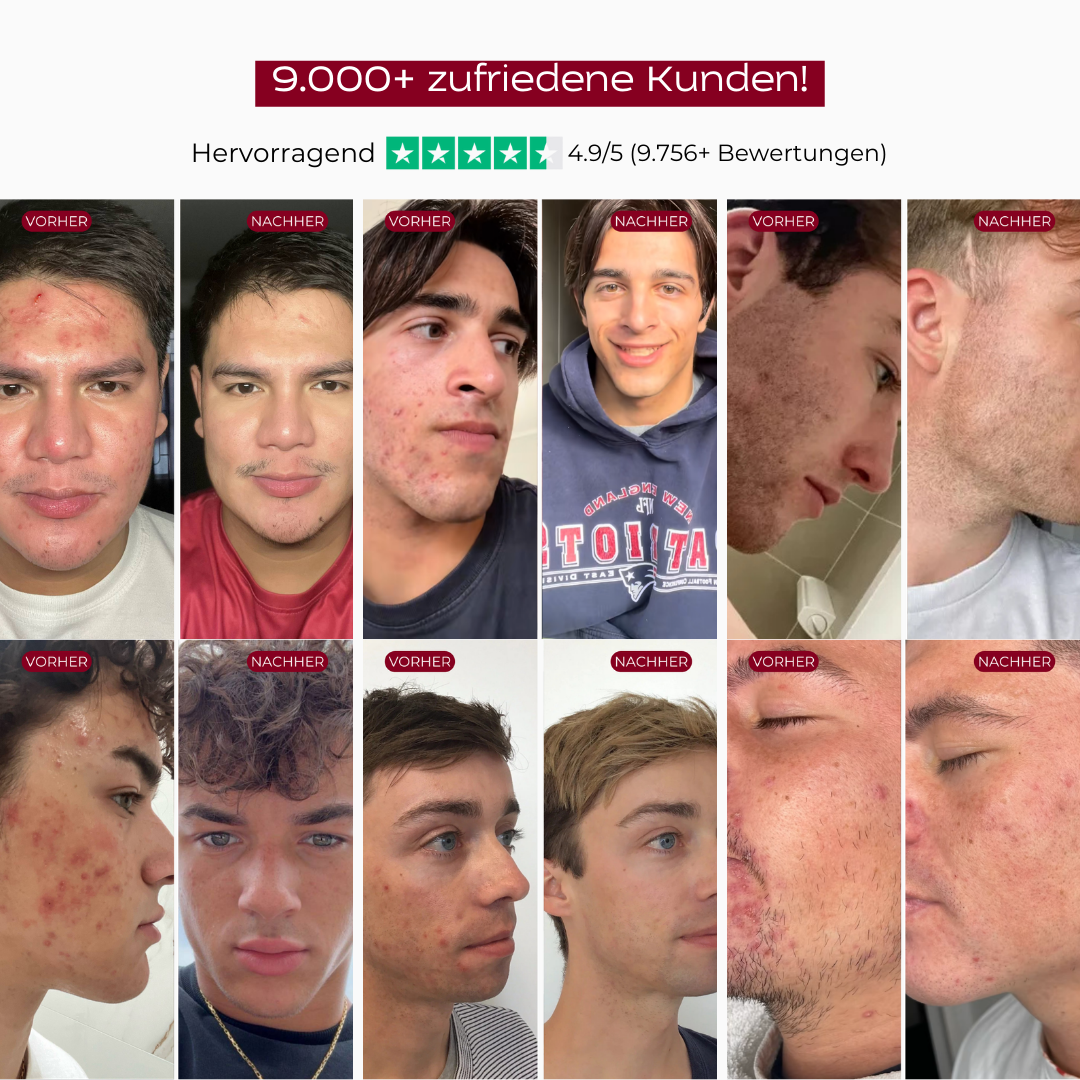 PureSkin™ Serum Duo | Men Edition