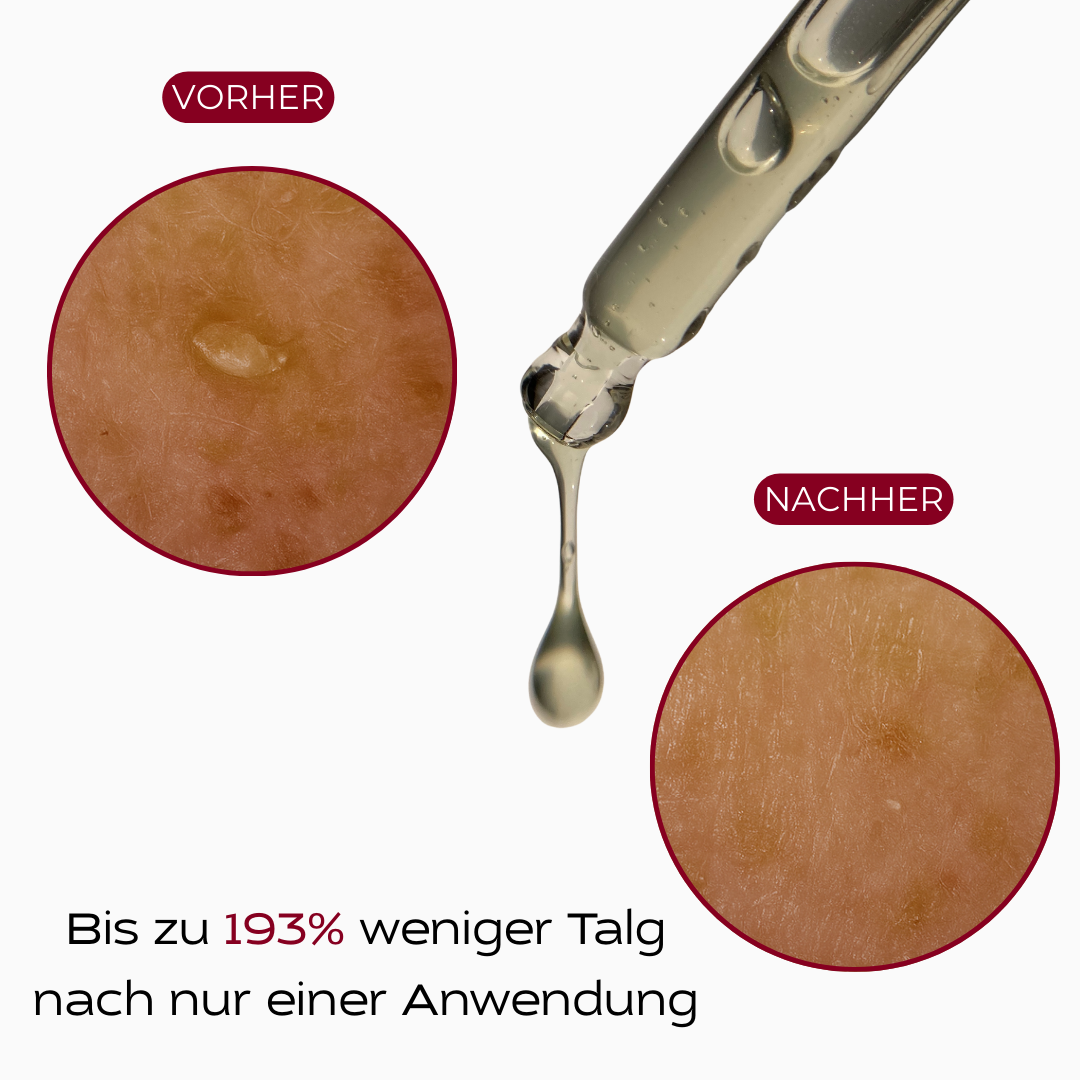PureSkin™ Peeling Serum (Schwarzer Reis)
