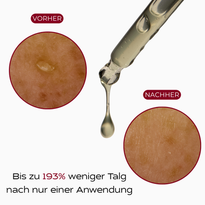 PureSkin™ Peeling Serum (Schwarzer Reis)