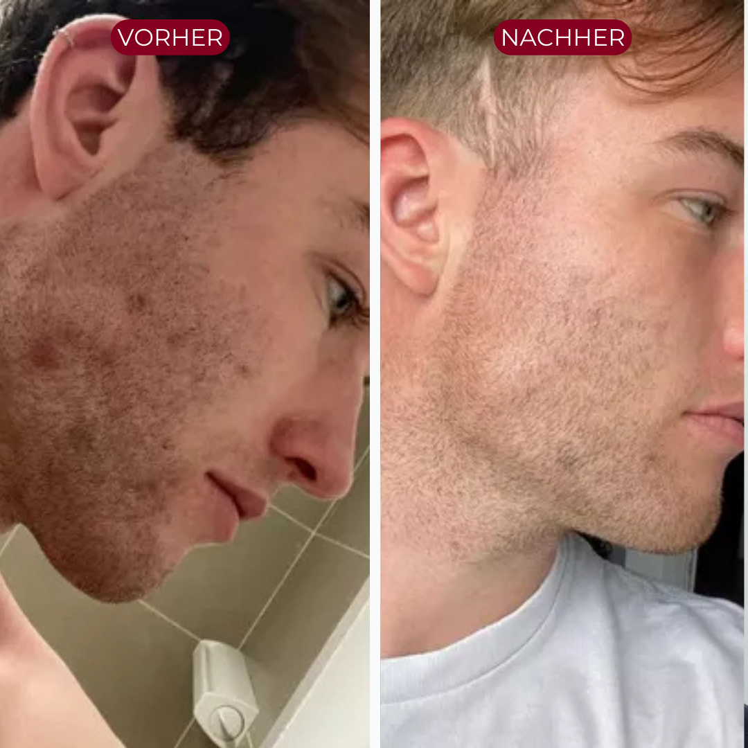 PureSkin™ Serum Duo | Men Edition