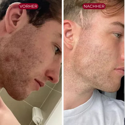 PureSkin™ Serum Duo | Men Edition