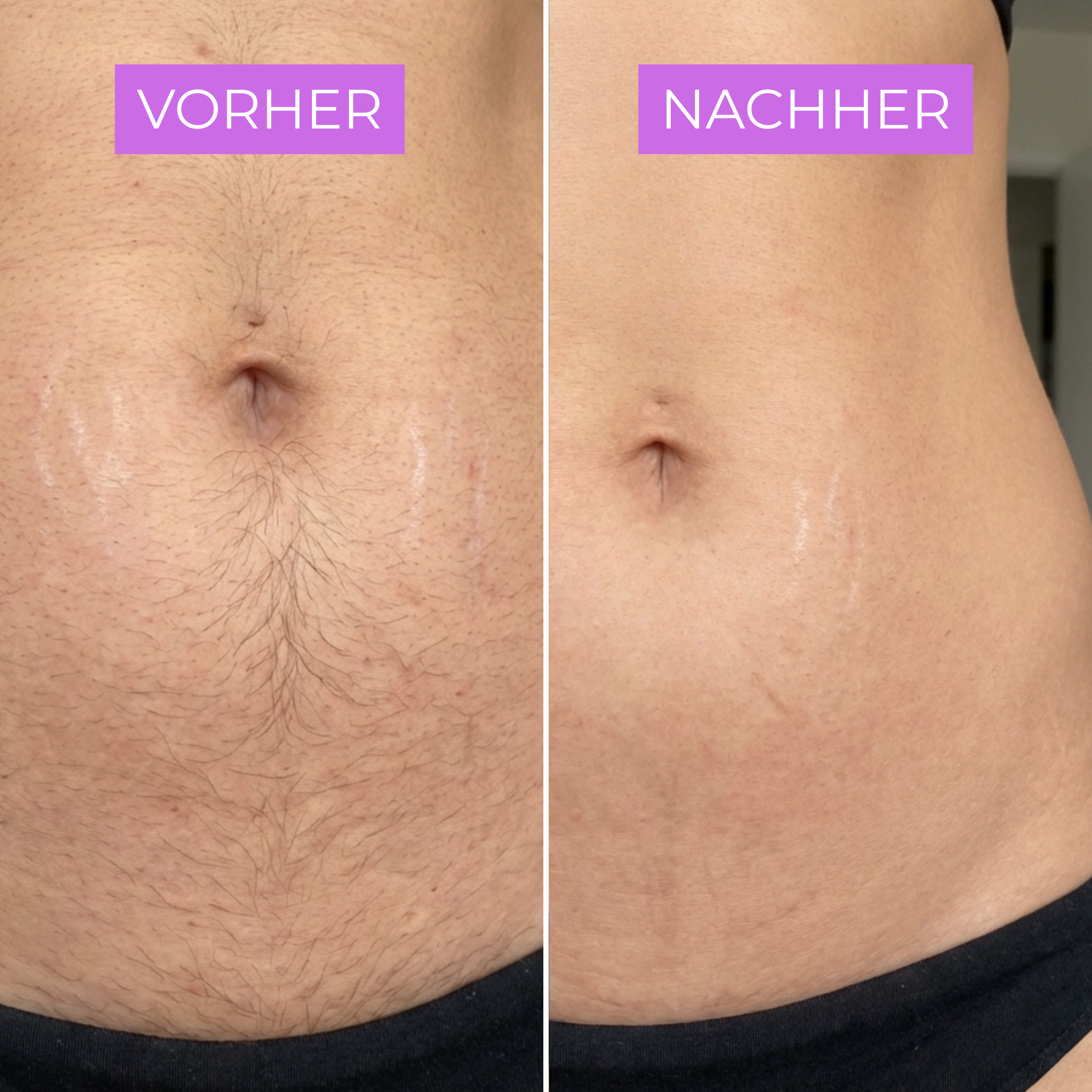 Cyperin Anti-Haar Serum