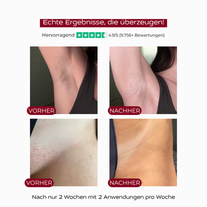 PureSkin™ Ganzkörper Peeling Spray