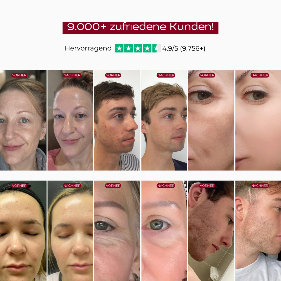 PureSkin™ Peeling Serum (Schwarzer Reis)